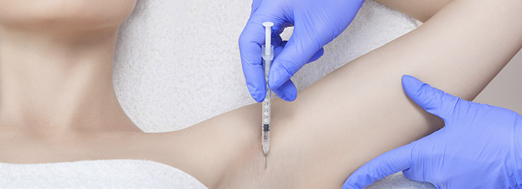 BOTOX FOR HYPERHIDROSIS