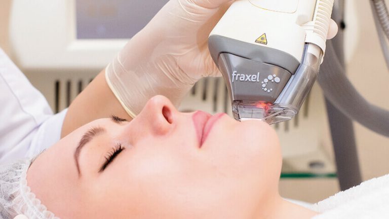 Fraxel Laser - Benefits, Costs, Results & Procedure Steps