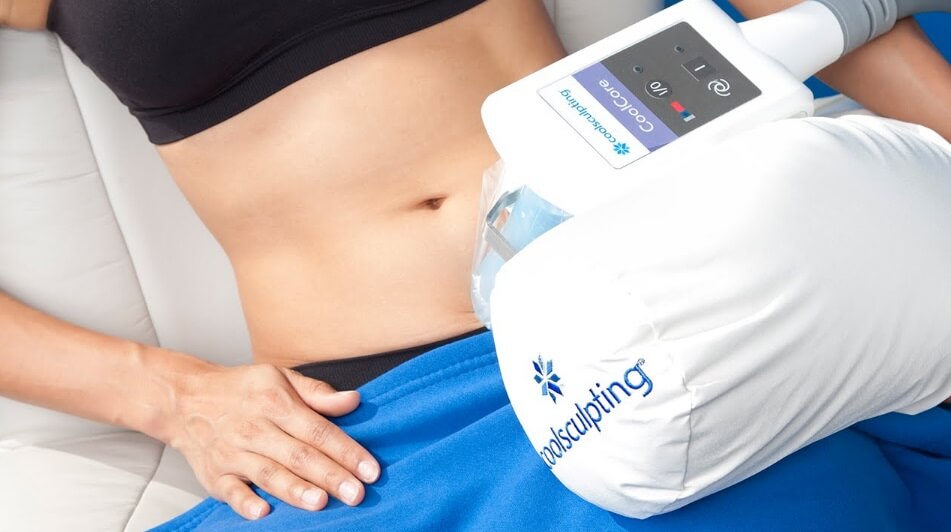 coolsculpting why to choose
