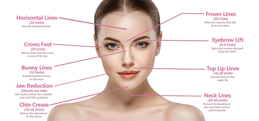 Botox crows feet before and after results