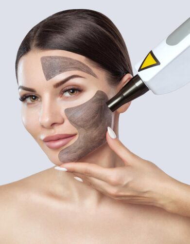 Carbon peel laser facial at Skinly Aesthetics