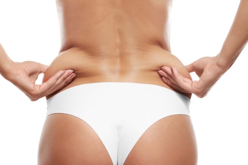 CoolSculpting procedure at Skinly Aesthetics