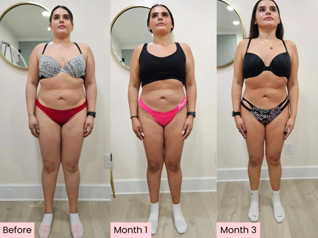 A side-by-side comparison of a patient’s weight loss journey using Ozempic in NYC.