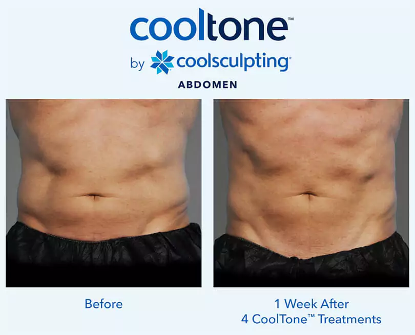 cooltone before after