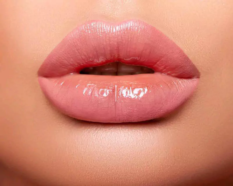 Lip filler injections