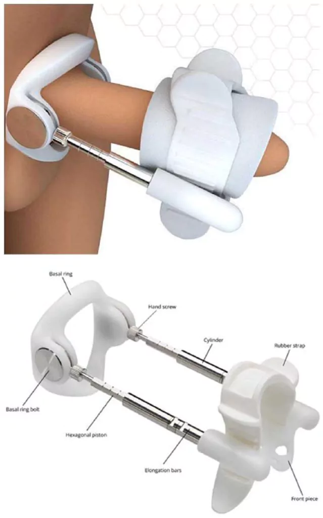 Penile traction device for lengthening